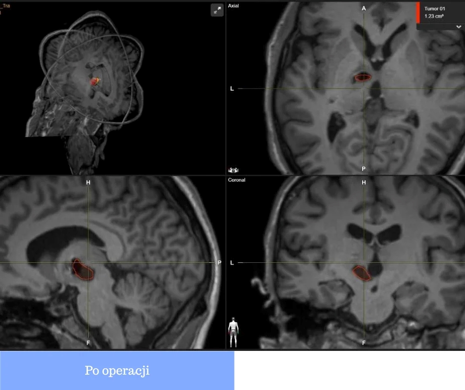 577057315 122156585204857013 2186059665457476974 n